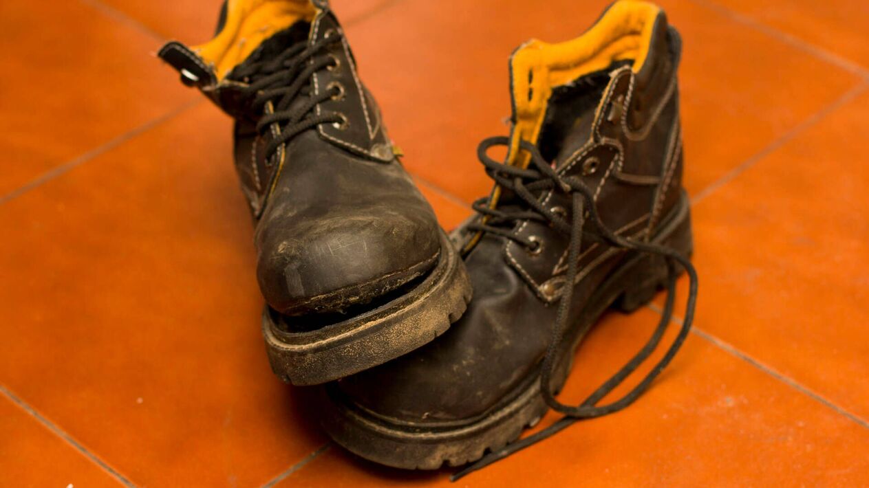 Os zapatos son unha das causas da infección por fungos